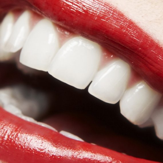Dental Check-Up With Optional Stain Removal, Or Laser Teeth Whitening DENTISTRY Shop Online at Special Price from Oman Mega Deals