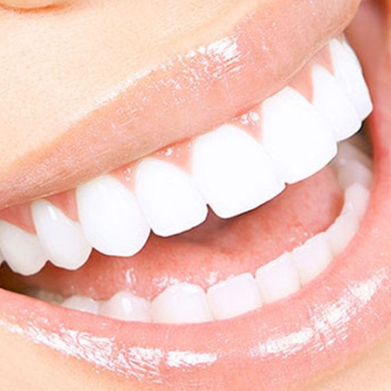 Scaling And Polishing With X-Ray At Omar Yahia Dental Surgery Clinic DENTISTRY Shop Online at Special Price from Oman Mega Deals